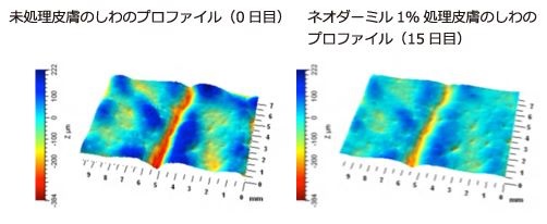 ネオダーミルのしわのプロファイル