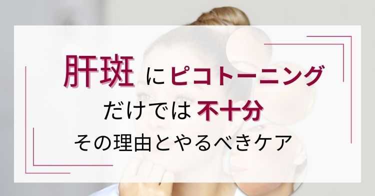 肝斑にピコトーニングだけでは不十分。その理由とやるべきケア